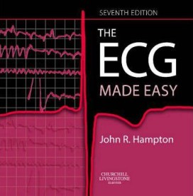 the ecg made